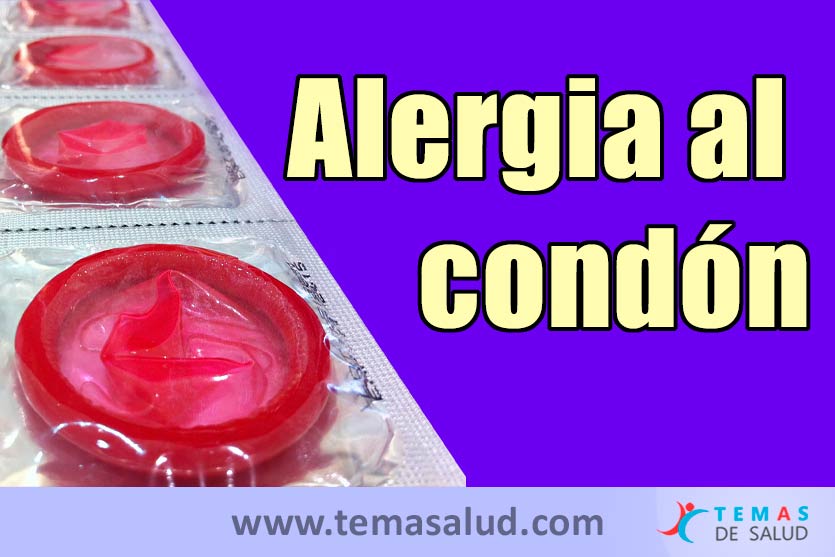Alergia al preservativo o condón